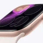 Apple Watch Series 11 | תמונה: אפל
